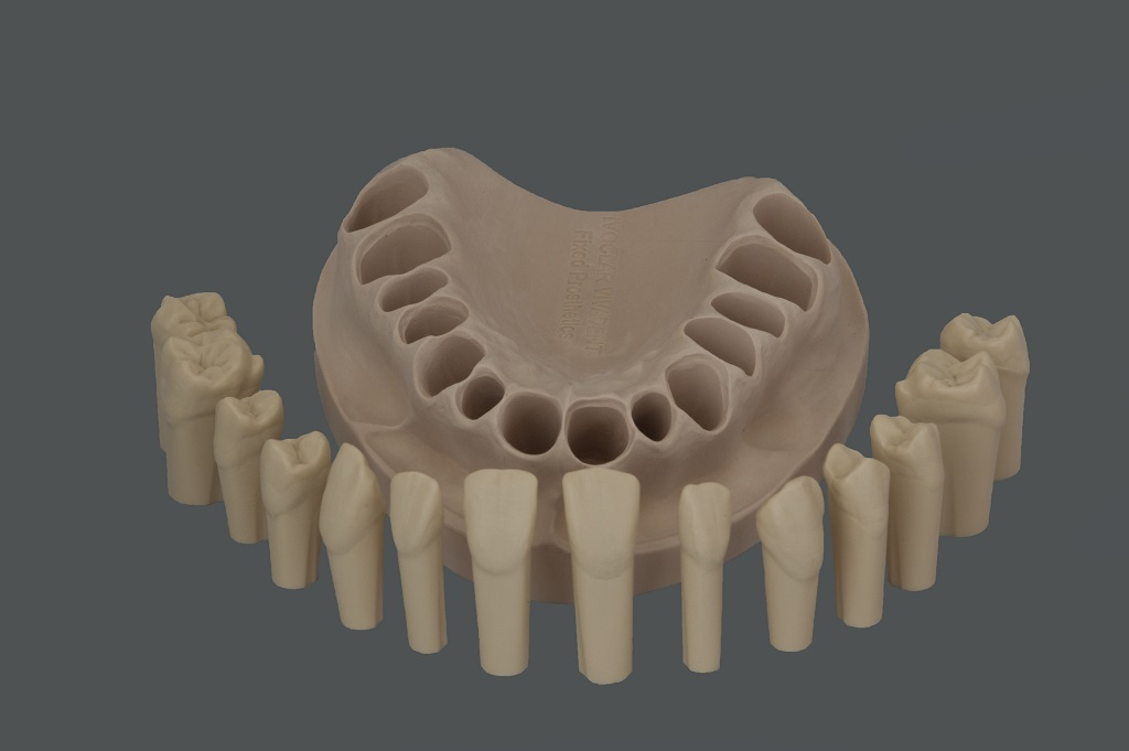 634000 MOD UJ IV Fixed Prosthetics.png