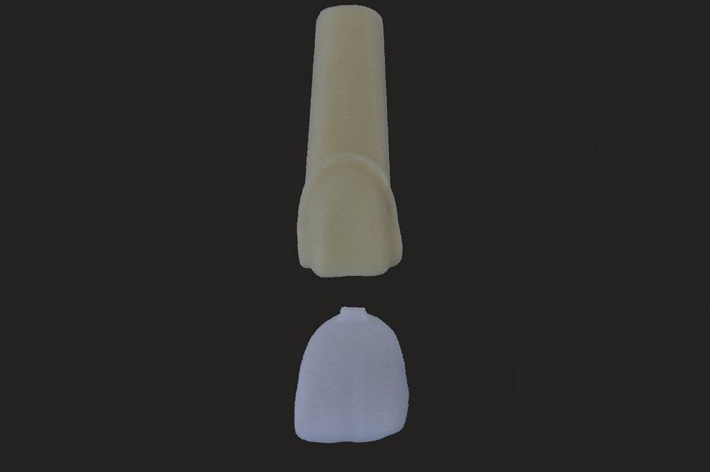 T124 634013  STR e.max CAD veneer 21 MT BL3.png